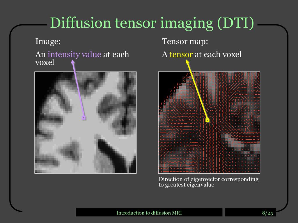 Introduction to diffusion MRI - ppt download